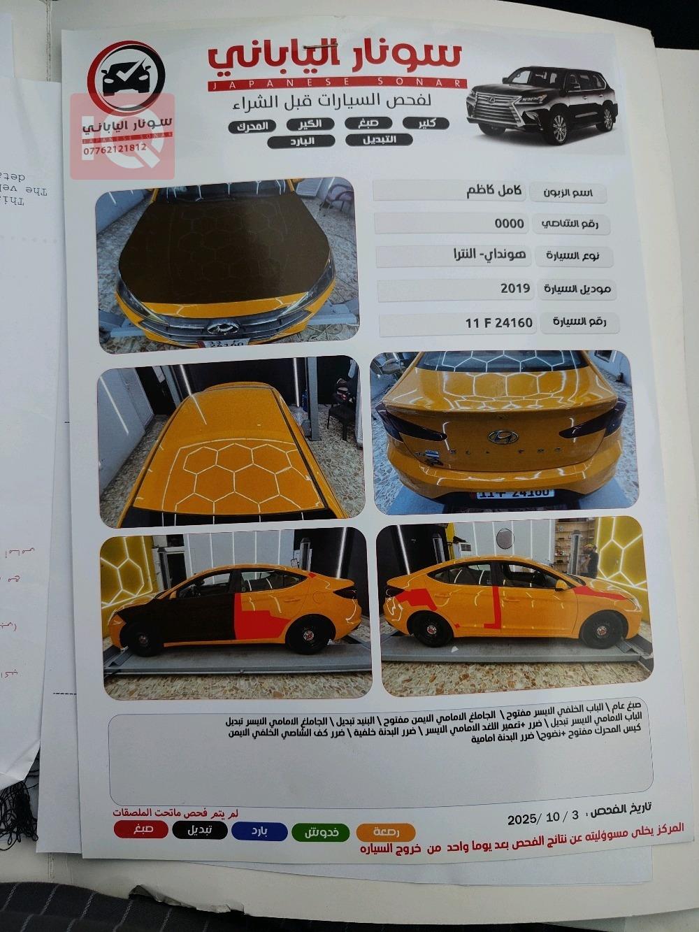 هيونداي النترا